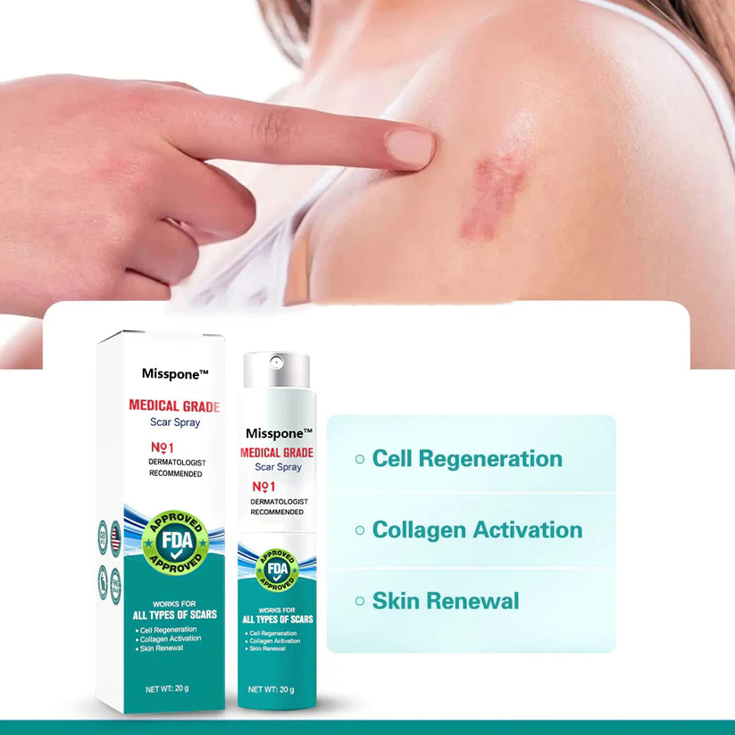 ❤️Misspone™ Advanced Scar Spray For All Types of Scars - For example Acne Scars, Surgical Scars and Stretch Marks