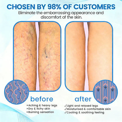 🇨🇦🏆COUGEX® VascuCare Vein Healing Spray(Designed for Varicose veins, Spider veins, Deep vein Thrombosis, Chronic venous insufficiency, Venous ulcers, Thrombophlebitis and other venous issues)