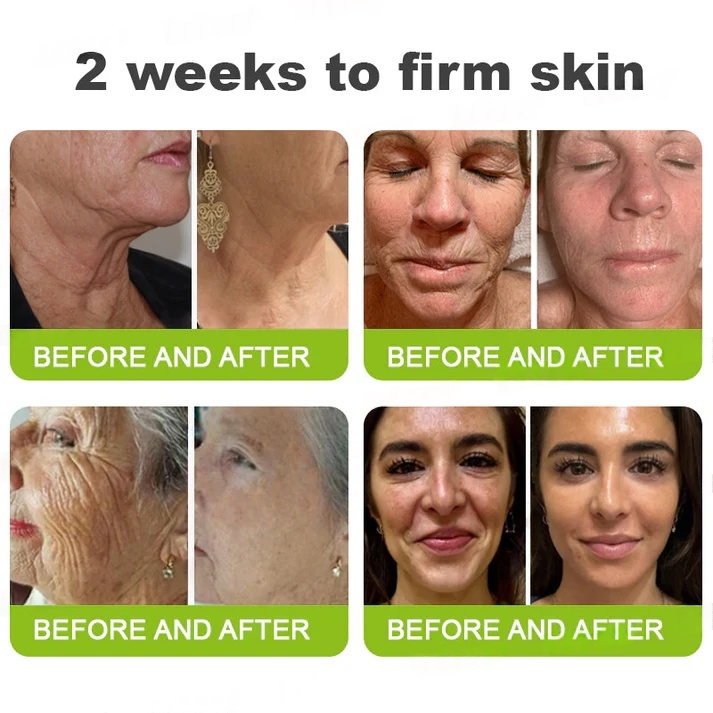 Final 3 Hours: 70%OFF🔥Botulinum & Vita-A Retinol Shot Wrinkle-Lift Tightening cream✨