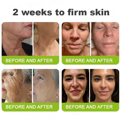 Final 3 Hours: 70%OFF🔥Botulinum & Vita-A Retinol Shot Wrinkle-Lift Tightening cream✨