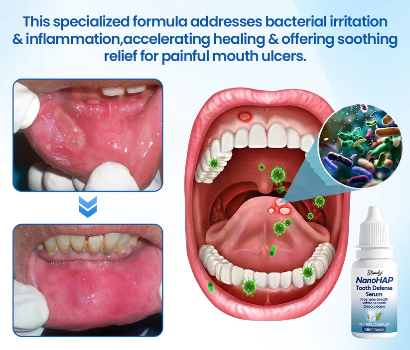 SLIMOLY® NanoHAP Tooth Defense Serum