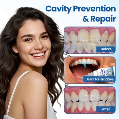 SLIMOLY® NanoHAP Tooth Defense Serum