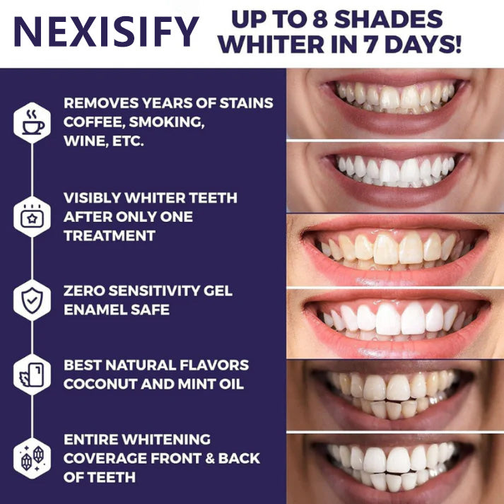 NEXISIFY Purple Teeth Whitening Strips