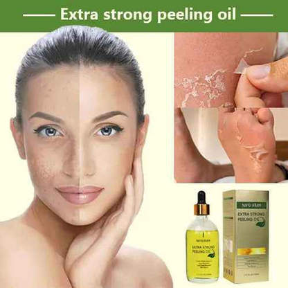 NESLEMY™Yellow Peeling Oil: Gentle Body Hyperpigmentation Treatment | Fade Dark Spots in 2 Weeks