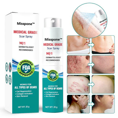 ❤️Misspone™ Advanced Scar Spray For All Types of Scars - For example Acne Scars, Surgical Scars and Stretch Marks