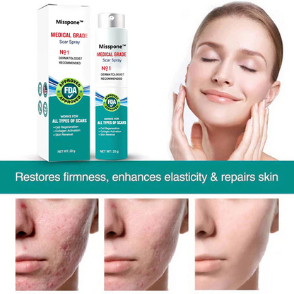 ❤️Misspone™ Advanced Scar Spray For All Types of Scars - For example Acne Scars, Surgical Scars and Stretch Marks