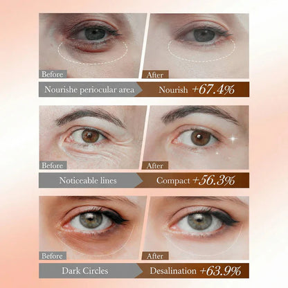 Eye Mask with Bio-Collagen Peptide Complex & Vitamin C