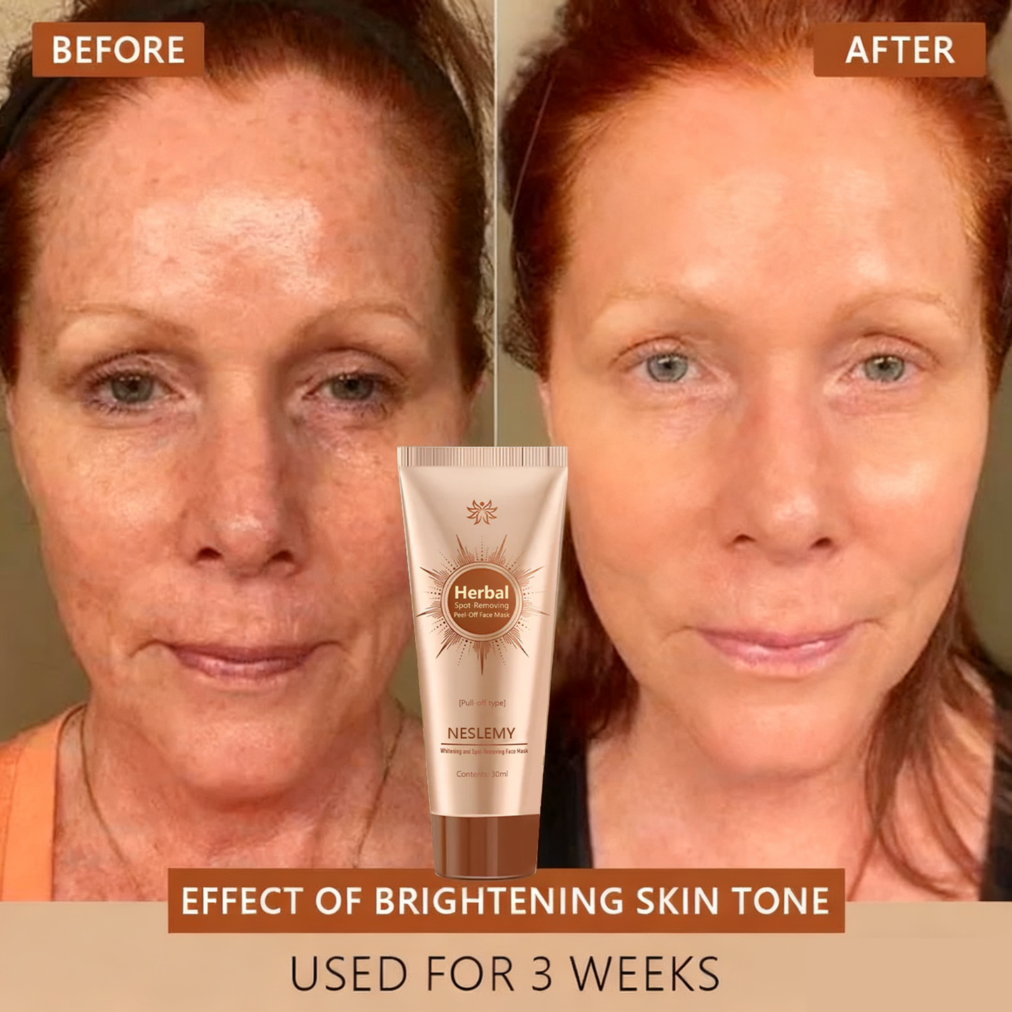 🏵️ NESLEMY™ Whitening and Spot-Removing Face Mask Suitable for face and body