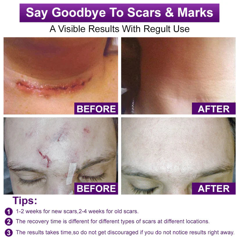 Purekin Scar Gel – Approved for Proven Scar Repair Visible Results, Healthier Skin, Renewed Confidence