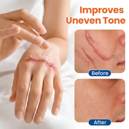 Purekin Dermal Rebuild Skin Repair & Restore Gel