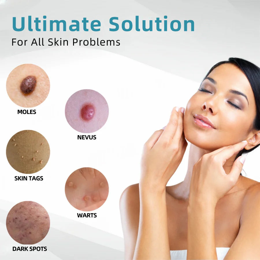 Purekin VelvetSkin+ Medical-Grade Laser Pen (Powered by CO2 laser technology – effectively removes moles, warts, skin tags, pigmentation spots, and other skin imperfections)