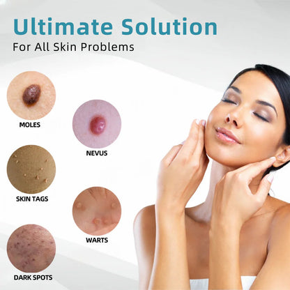 Purekin VelvetSkin+ Medical-Grade Laser Pen (Powered by CO2 laser technology – effectively removes moles, warts, skin tags, pigmentation spots, and other skin imperfections)