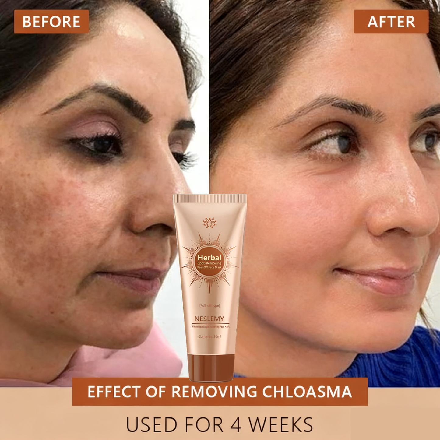 🏵️ NESLEMY™ Whitening and Spot-Removing Face Mask Suitable for face and body