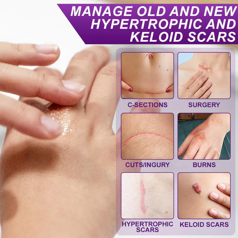 Purekin Scar Gel – Approved for Proven Scar Repair Visible Results, Healthier Skin, Renewed Confidence