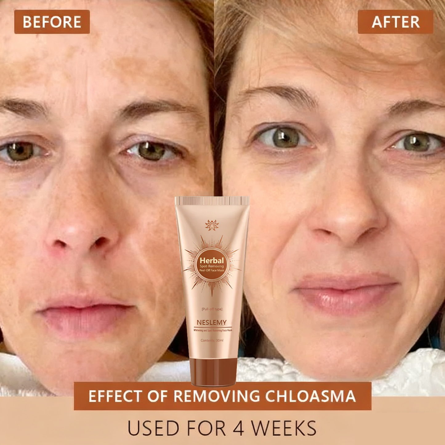 🏵️ NESLEMY™ Whitening and Spot-Removing Face Mask Suitable for face and body