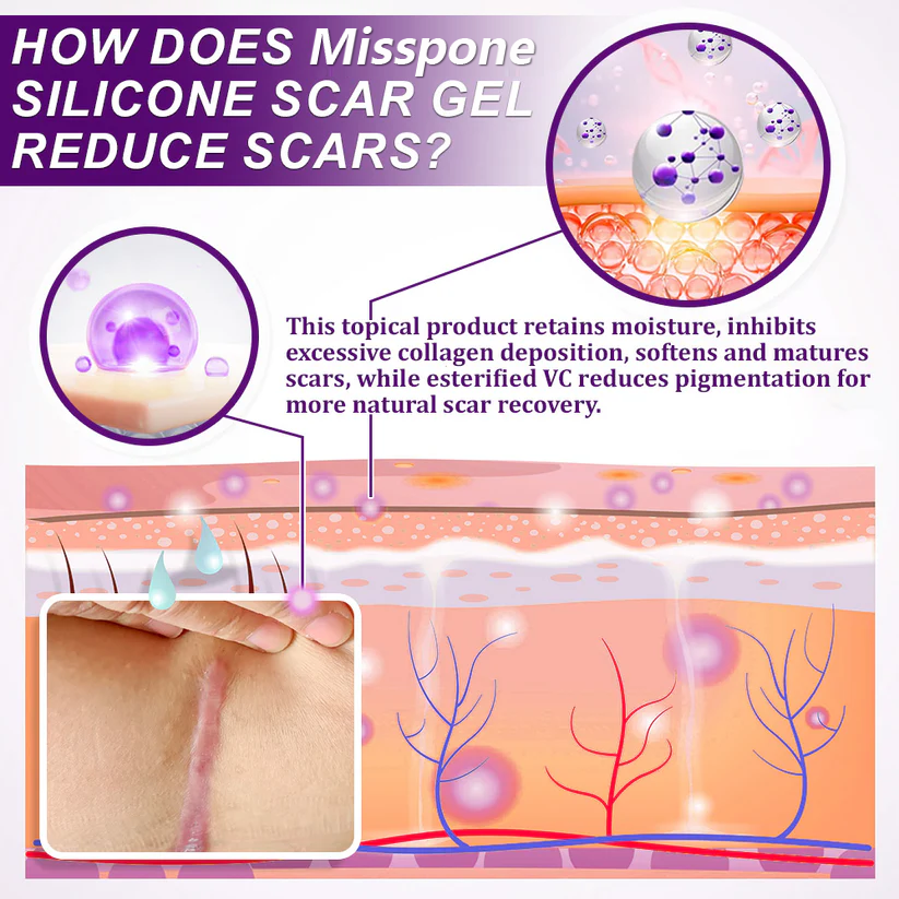 Purekin Scar Gel – Approved for Proven Scar Repair Visible Results, Healthier Skin, Renewed Confidence