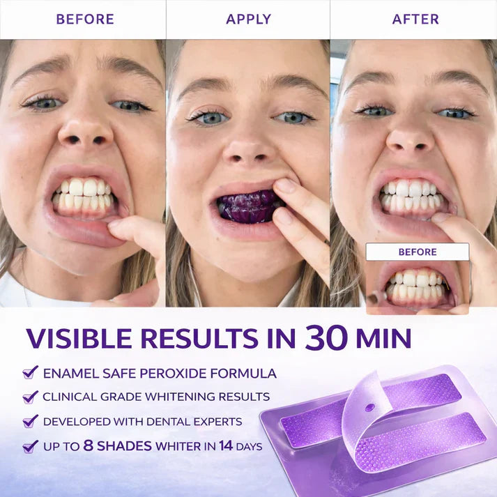 NEXISIFY Purple Teeth Whitening Strips