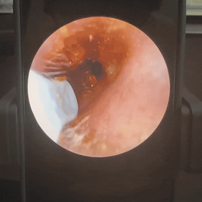 Purekin VisioEar: Doctor Approved Ear Health Technology