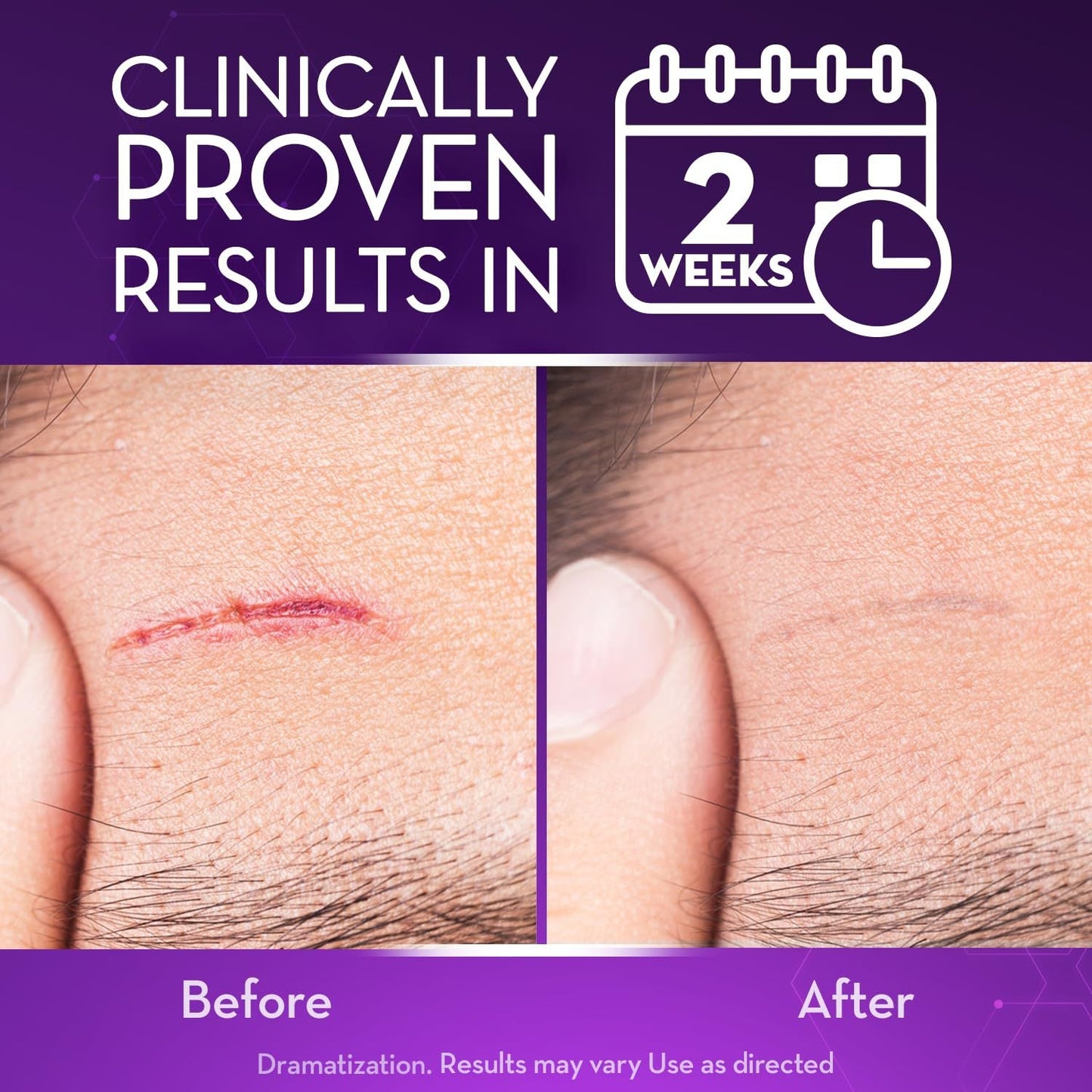 Purekin Scar Gel – Approved for Proven Scar Repair Visible Results, Healthier Skin, Renewed Confidence