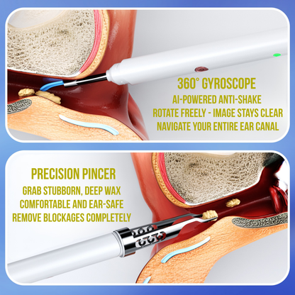 Purekin VisioEar: Doctor Approved Ear Health Technology