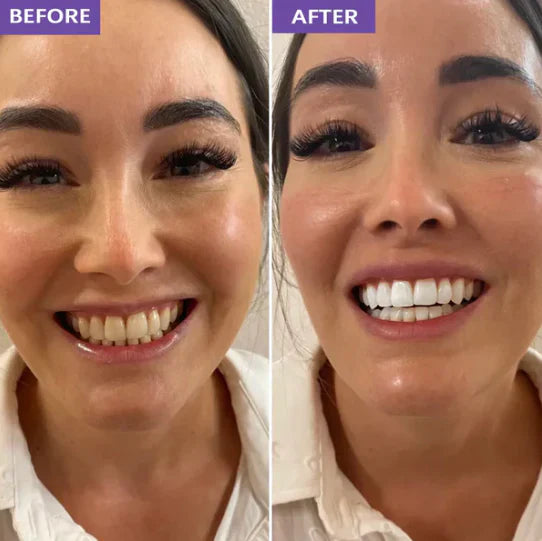 NEXISIFY Purple Teeth Whitening Strips