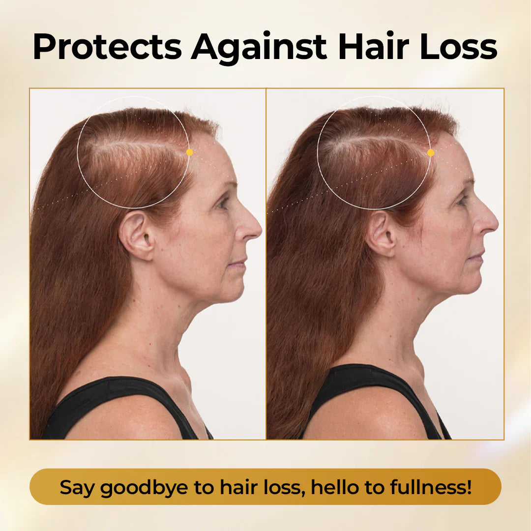 Misspone®Peptide Hair Restore Spray