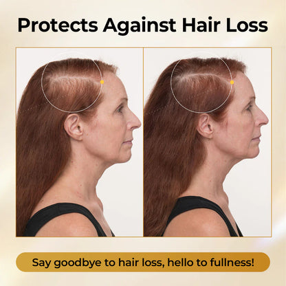 Misspone®Peptide Hair Restore Spray