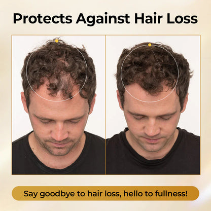 Misspone®Peptide Hair Restore Spray
