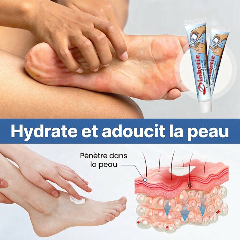 Crème de traitement du diabète Purekin VitaGluco
